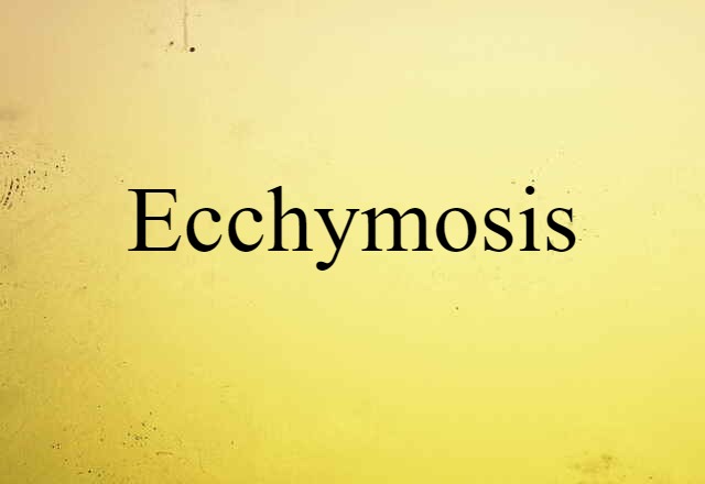 ecchymosis