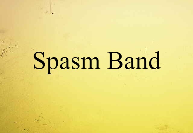 Spasm Band (noun) Definition, Meaning & Examples