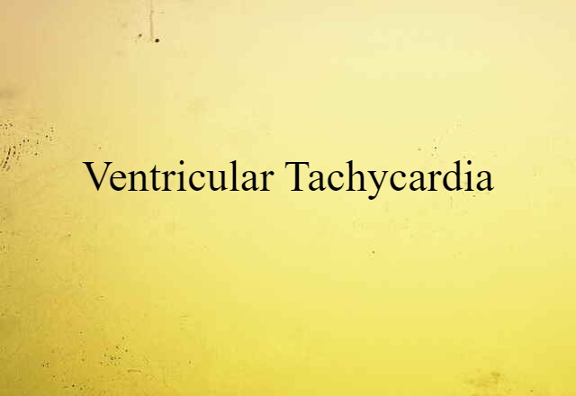 ventricular tachycardia